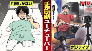 【感動】事故で手足切断した男…ユーチューバーになる。世界一ポジティブ。