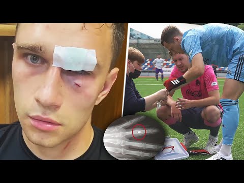 САМЫЕ СТРАШНЫЕ ТРАВМЫ НА ФУТБОЛЬНОМ ЮТУБЕ / 3 ЧАСТЬ