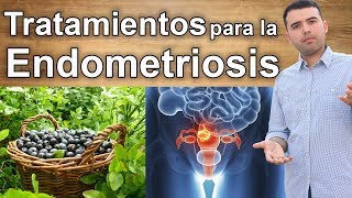 ¿Que es la Endometriosis? - Tratamientos Naturales y Alimentos para Curarla