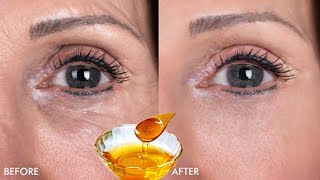 Anti-aging honey cream, makes you 10 years younger, erases all wrinkles and fine lines