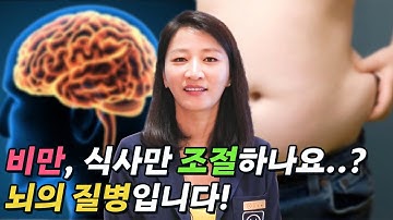 비만인데 칼로리 조절만 해서 실패하시나요? 비만도 브레인(brain) 질병입니다!