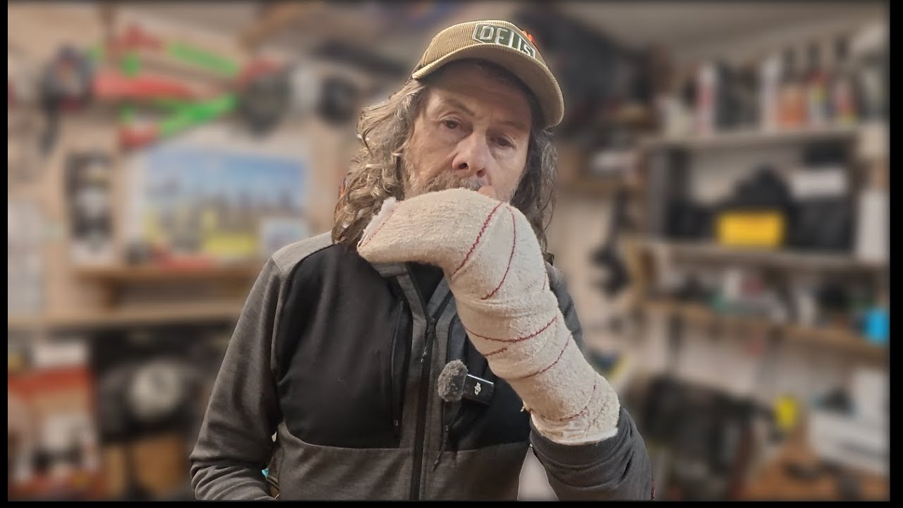 Я порвал сухожилие на руке, а колеса у меня 32-дюймовые!