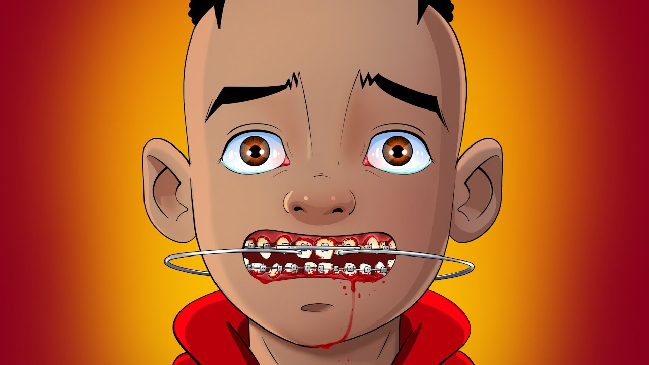 How Do Schools Deal With Braces?