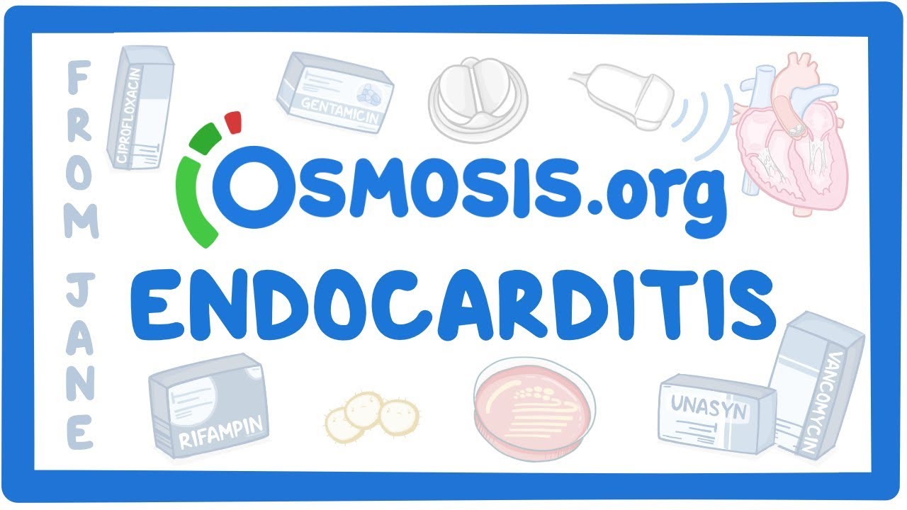 Clinician's Corner: Endocarditis