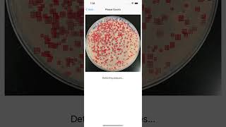 OnePetri: A mobile phone app for counting bacteriophage Plaques and bacterial colonies on a plate screenshot 5
