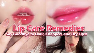 Diy Remedies For Pink, Soft Lips No More Dry, Chapped, Or Dark Lips