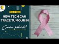 New technology may help to identify tumour spread in breast cancer patients | Tech in Trend