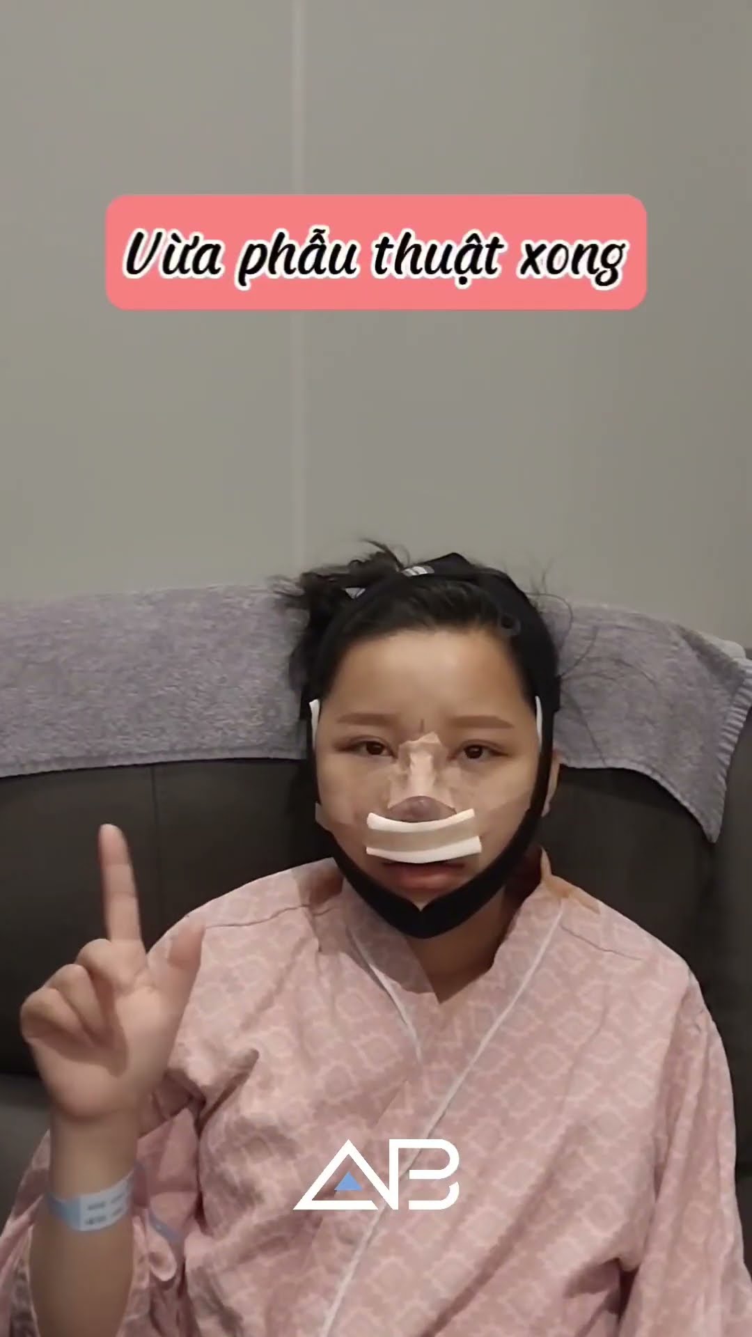 [Plastic Surgery in Korea] Kết quả thẩm mỹ của khách làm TÁI NÂNG MŨI SỤN SƯỜN + HẠ GÒ MÁ