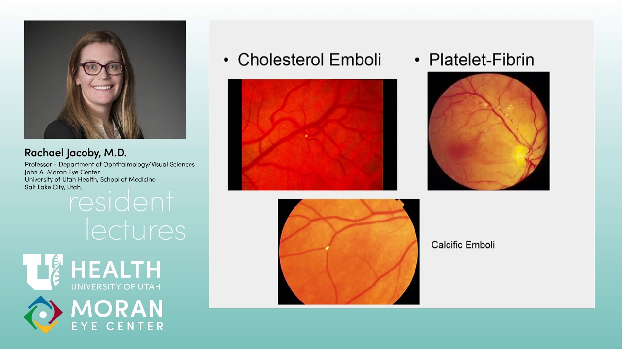 Retinal Vascular Disease [ARCHIVE] - YouTube