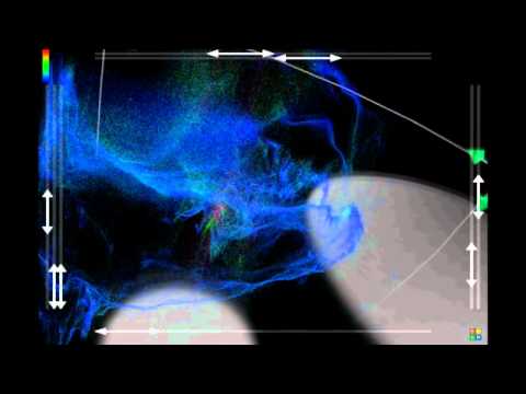 HearBeatBox_VidII.avi
