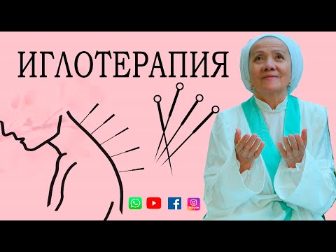 Иглотерапия-что лечит и как работает
