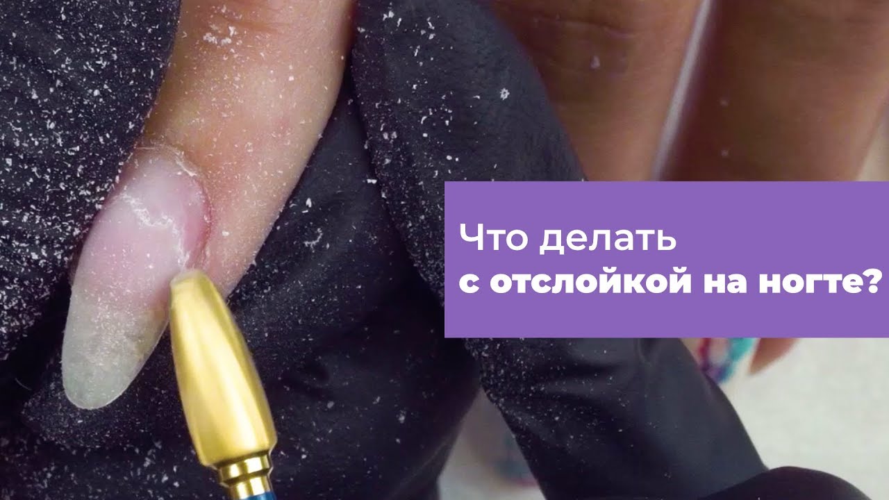 Как избежать отслоек