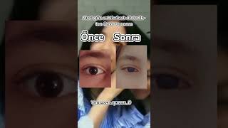 Bir Değişiklik Varmı Sizce Bence O Kadarda Yok 1 Hafta Dinledim