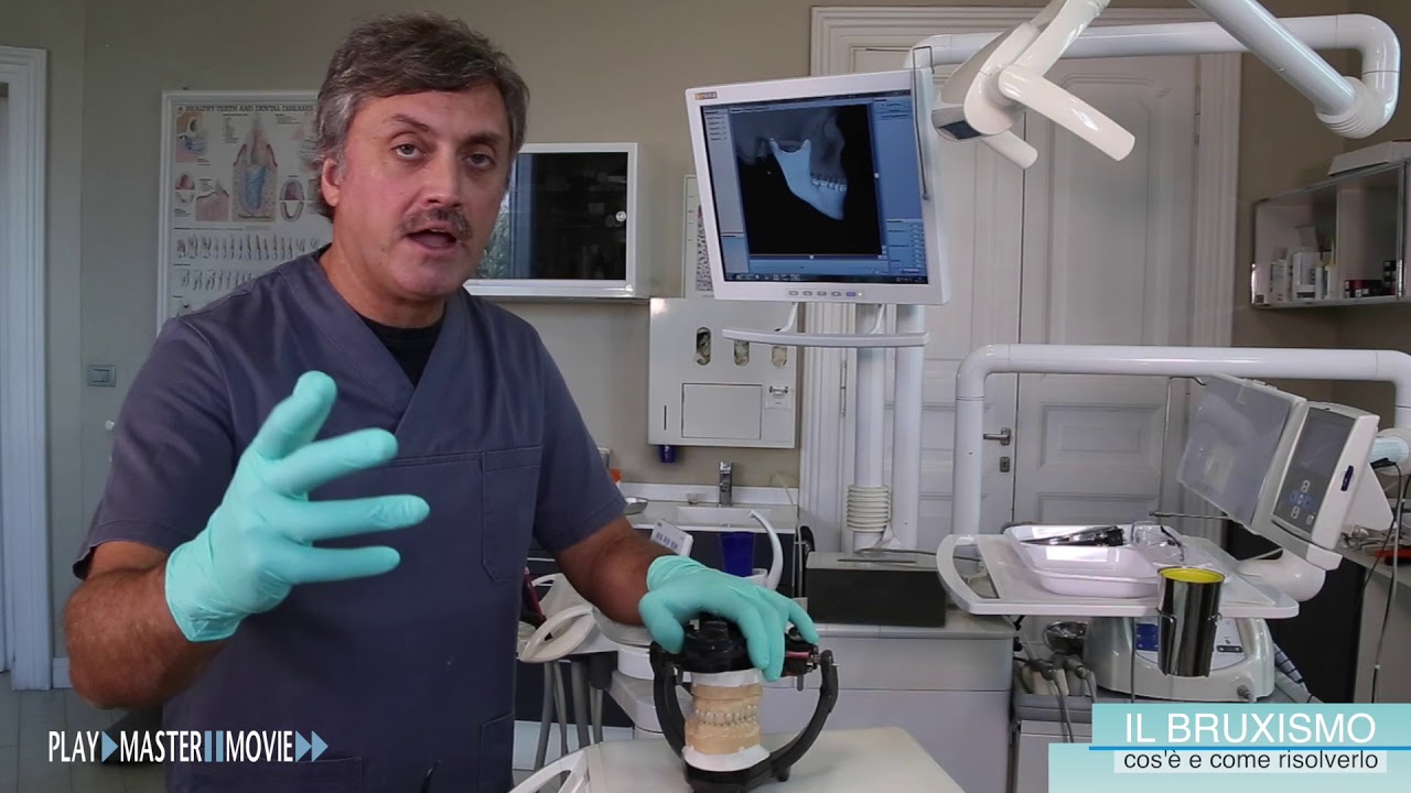 Gnatologia per tutti #2   il Bruxismo
