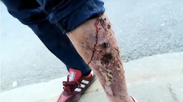 😯🤯Shocking video shows zombie-like addicts at ‘ground zero’ of Philadelphia’s ‘tranq’ epidemic🤯🤮