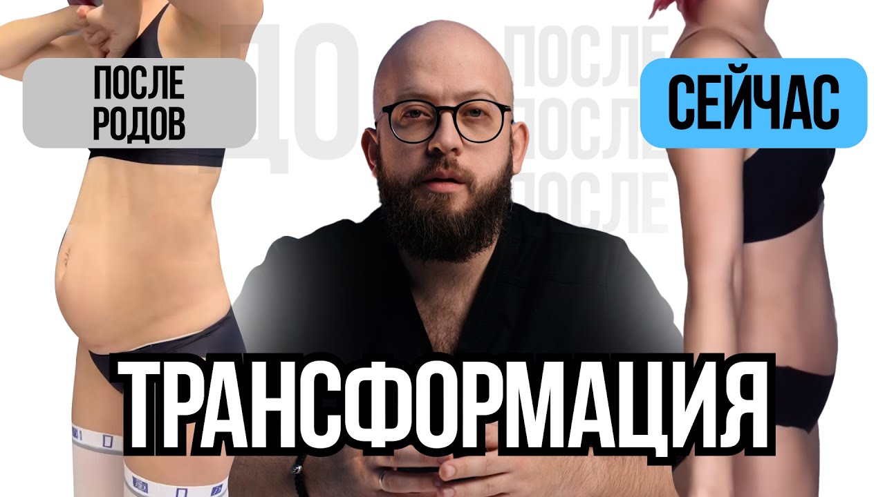 Простой способ восстановиться после родов в 2023. убрать живот и ...