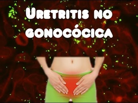 qué y uretritis no gonocócicas