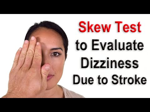 Skew Test to Evaluate Dizziness Due to Possible Stroke