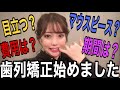 【インビザライン】歯列矯正始めました!!決め手・費用お話します!#1【マウスピース】