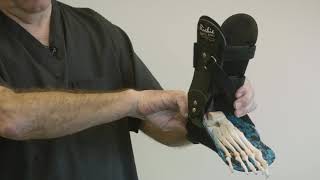 Clinical Pearls of AFO Therapy - Flanges and Suspenders