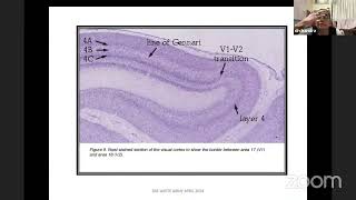 Higher order Visual processing