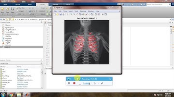 IEEE 2015 MATLAB LUNG SEGMENTATION