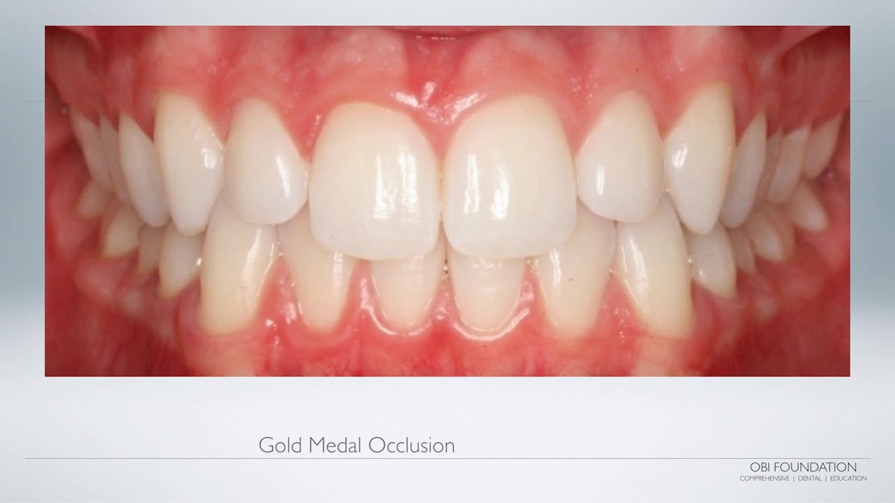 Level I   Minimally Invasive Complete Care Dentistry presented by OBI Director of Education, Dr  Jam