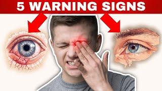 5 WARNING Signs of Dry Eyes (Expert Eye Surgeon Explains)