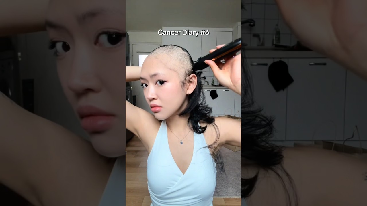 Sakit Kanker Sampai Rambutnya Botak😱