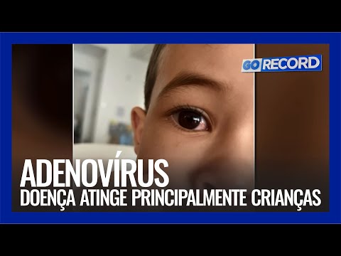 Vídeo: Qual vírus causa a doença do tapa?