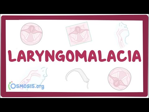 Laryngomalacia - an Osmosis Preview