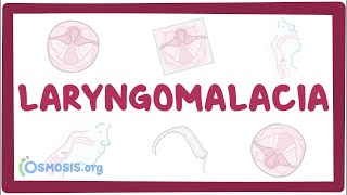 Laryngomalacia - an Osmosis Preview screenshot 5