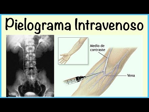 Pielograma Intravenoso: Medicina Rápido y Fácil