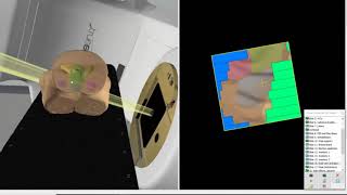 How to use the Radiotherapy Introduction Session workbookYouTube