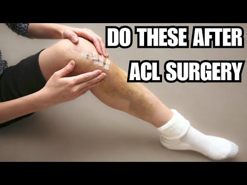 ACL Rehab Weeks