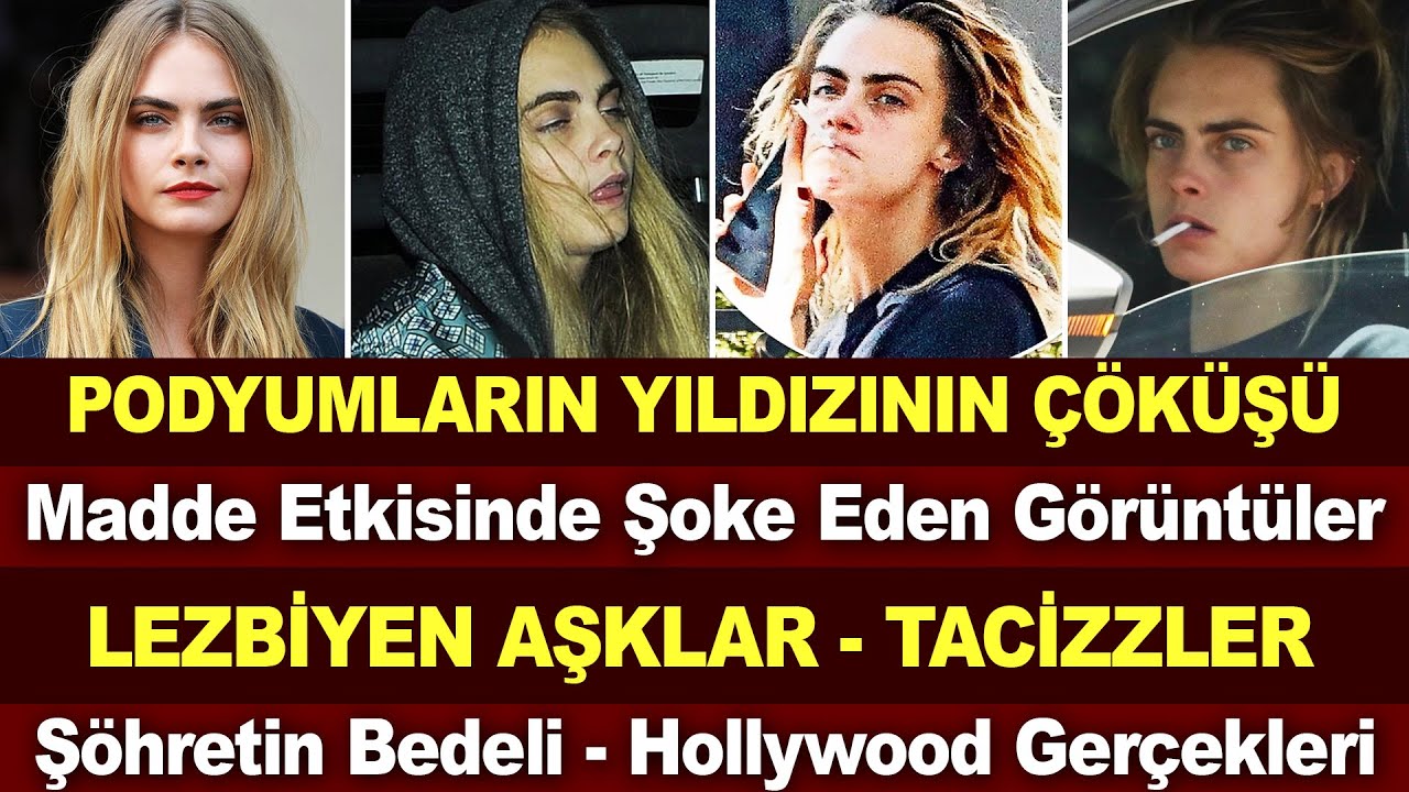 Cara Delevingne; Bir Süper Modelin Çöküşü... Son Hali Hollywood'un Karanlık Yüzünü Gösterdi...
