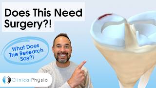 Traumatic Meniscal Tears | Surgery or Physiotherapy? What Does the Evidence Say?