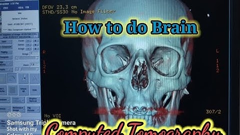 How to do Basic  CT SCAN Brain Plain, Exclusive for Rad. Tech.  Beginners