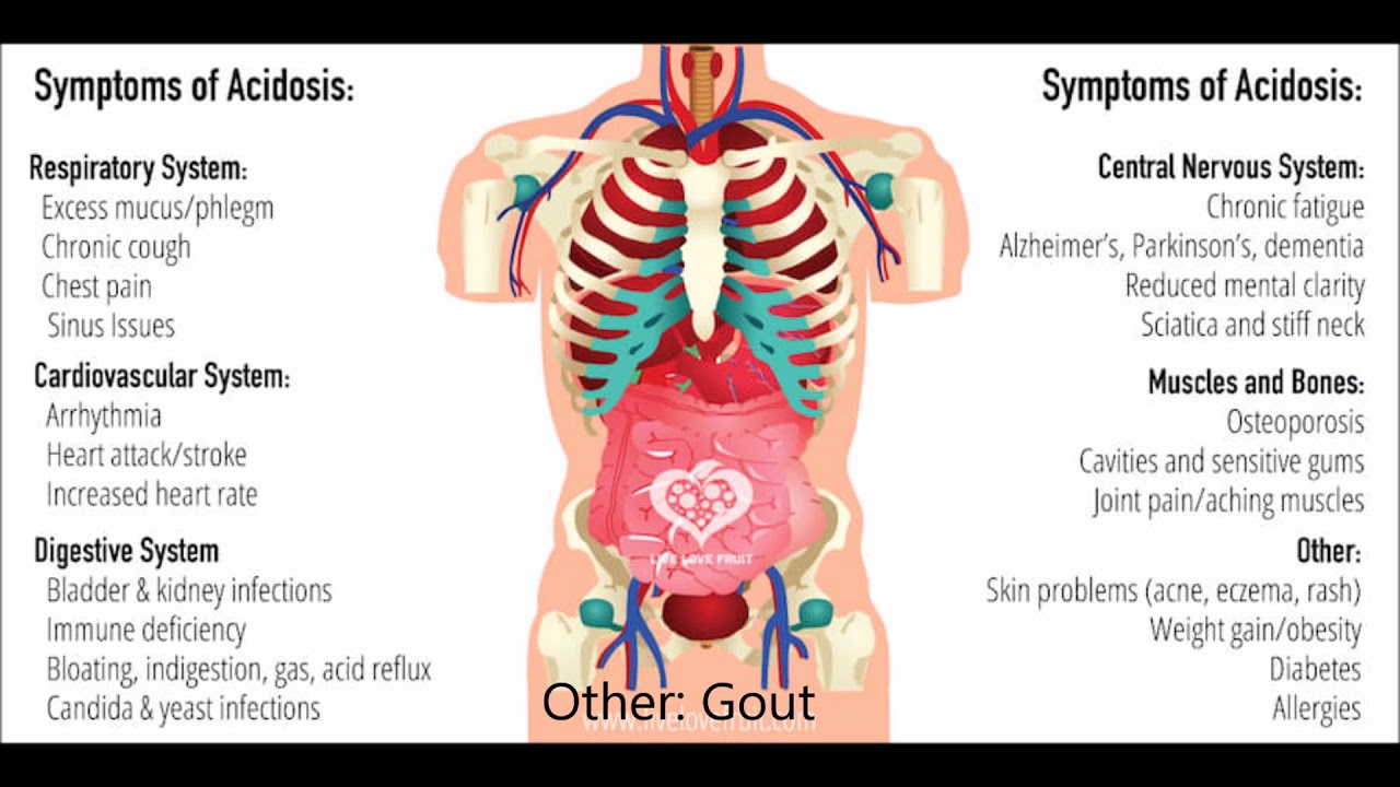 Quickest Way to Cure Gout Alkaline Water Rid Uric Acid Levels fast