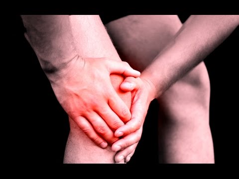 Болят суставы рук и ног что делать ! Как лечить боли в суставах - №13 Артрит. Артроз/#edblack