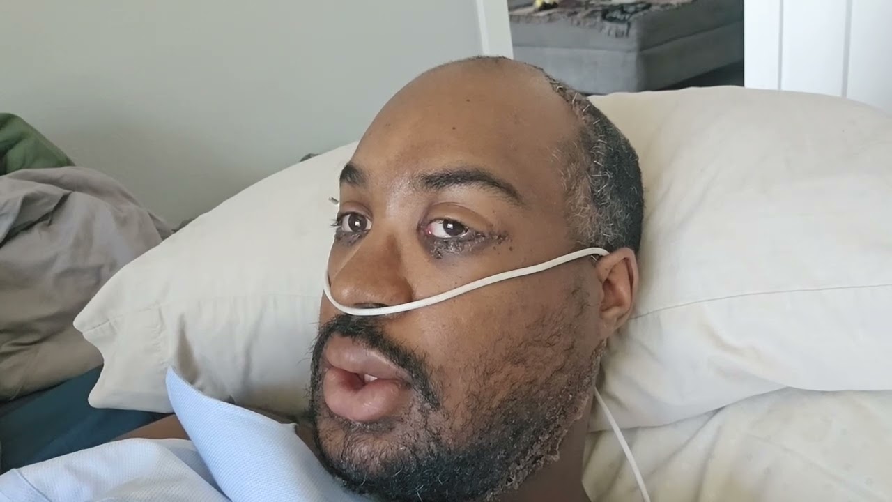 "When your homie comes to visit you in the hospital after surgery"....Feat./@trarags , on YouTube