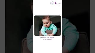 Baby Fell Off the Bed?  What Every Parent Must Do Immediately | Dr. Sandeep