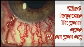 This is What Happens to your eyes when you cry.
