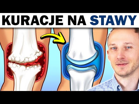 Wideo: 4 sposoby na leczenie bólu stawów poprzez dietę