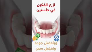 زراعة الاسنان -بعيادات رويال الرياض جودة عالية وبأفضل الاسعار
