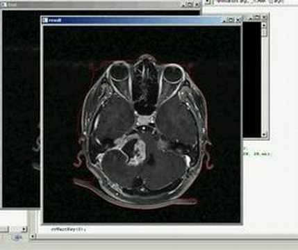 Active Contour Evolution