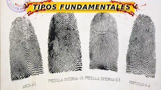 Aprende a estudiar HUELLAS DACTILARES | Dactiloscopia screenshot 4
