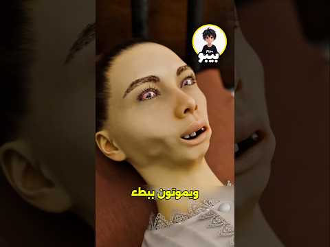 أعواد الثقاب القاتلة مرض فك الفوسفور المروع 