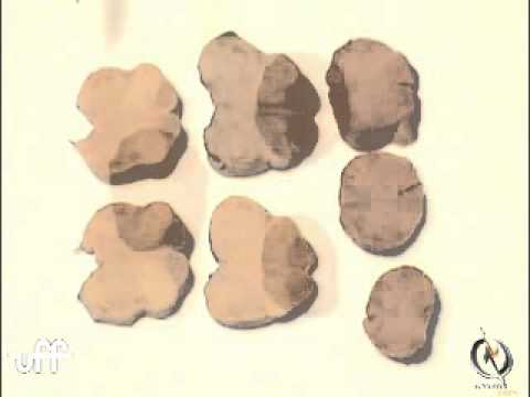 bulbo corte transv parte 1 anatomia abdominal