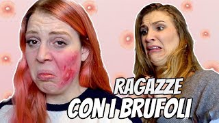 Ragazze Con I Brufoli